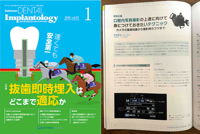 デンタルインプラントロジー